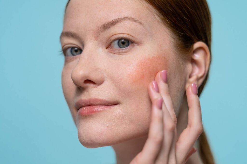 Spring Onset Rash Spring Skin Allergies: Hives & Rashes | Park Plaza Dermatology