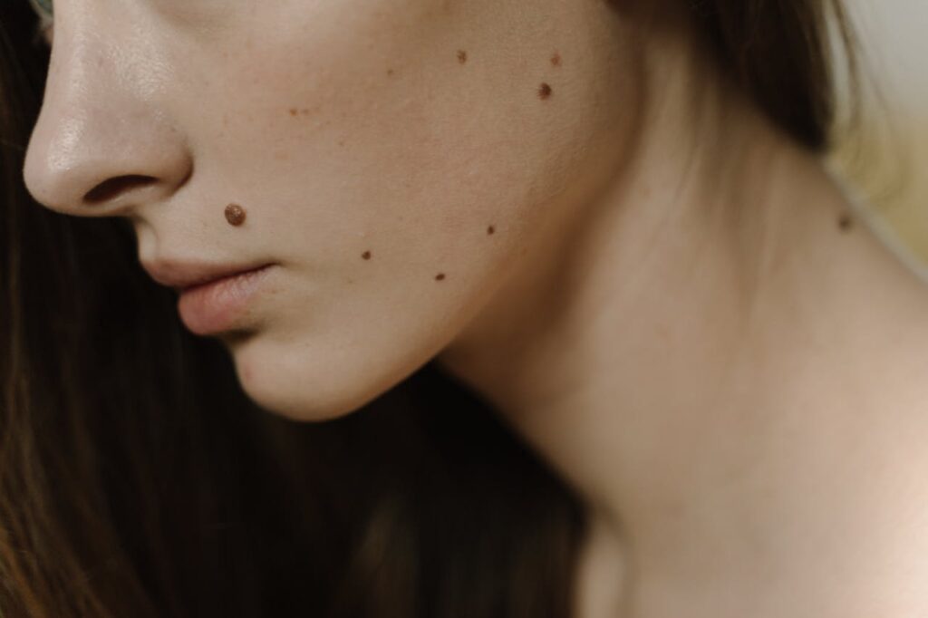 Mole